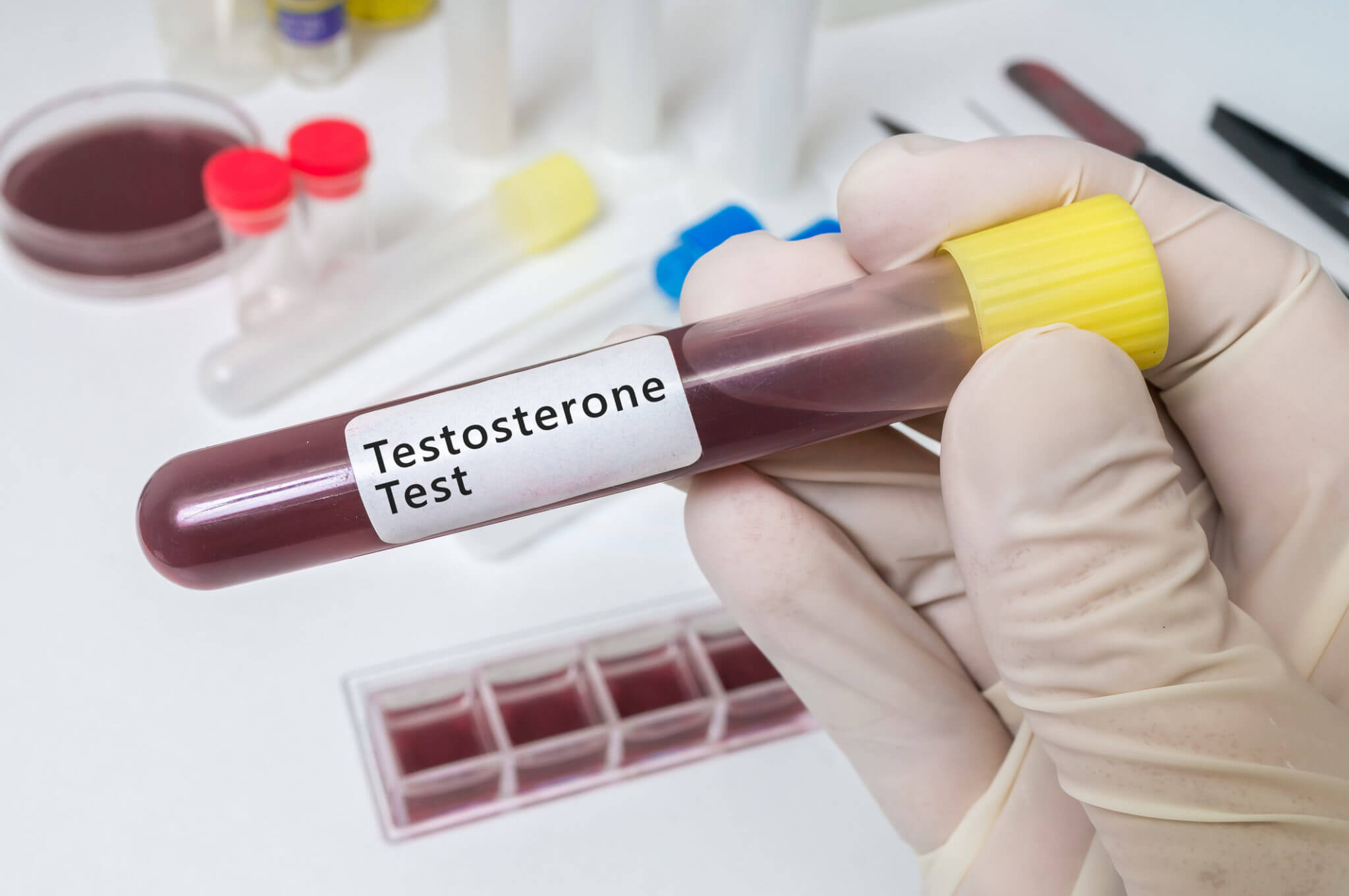 testosterona