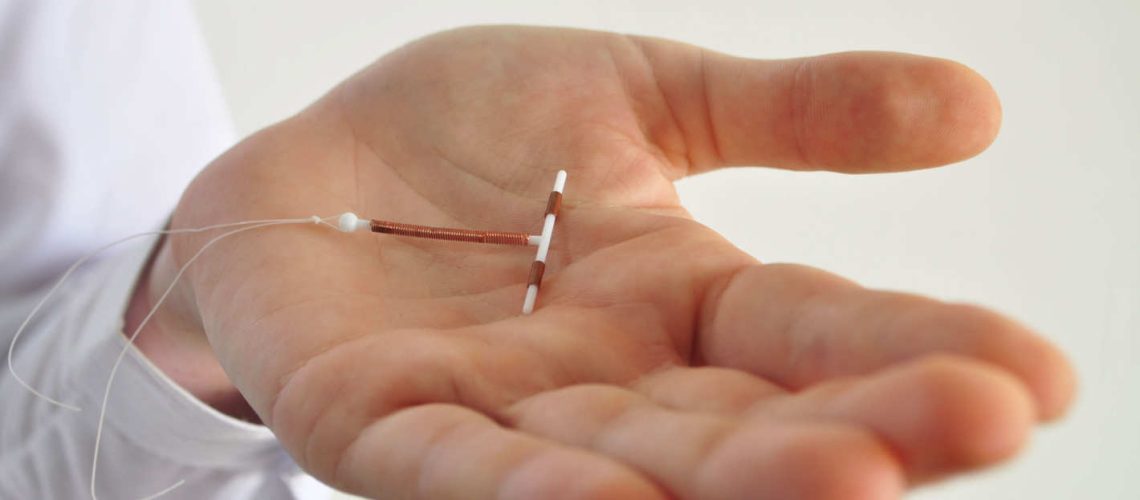diu mirena
