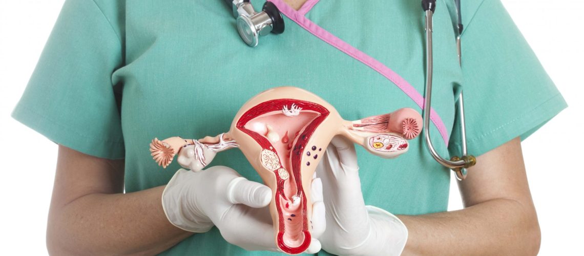 Pólipo endometrial