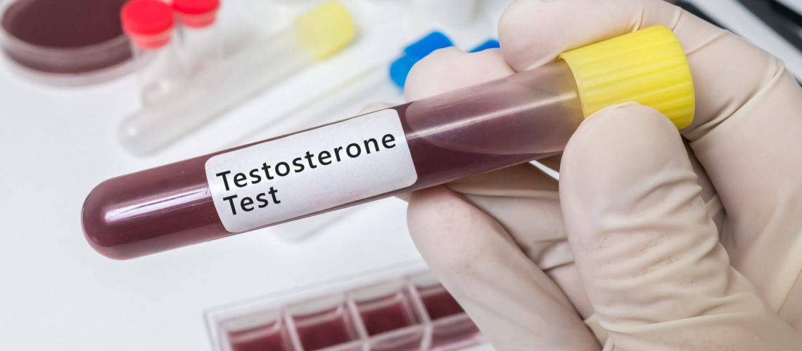 testosterona